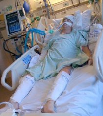 November 11, 2008 - Day after Transplant